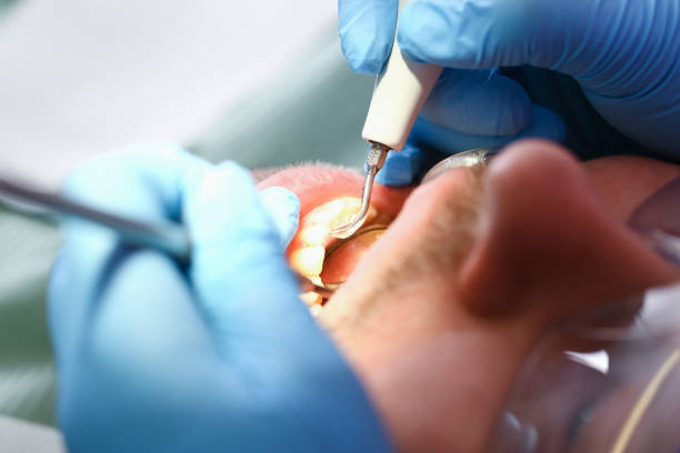 Emergency Dentist for Kids in NC