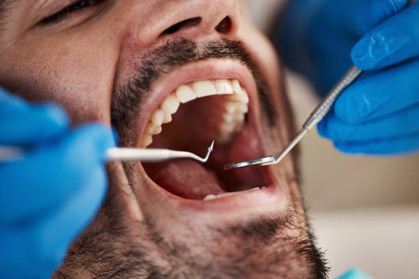 Best Emergency Tooth Extraction  in Mountain Home, NC